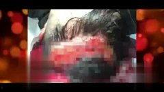 泻血视频,传统养生与现代视角下的神奇疗效